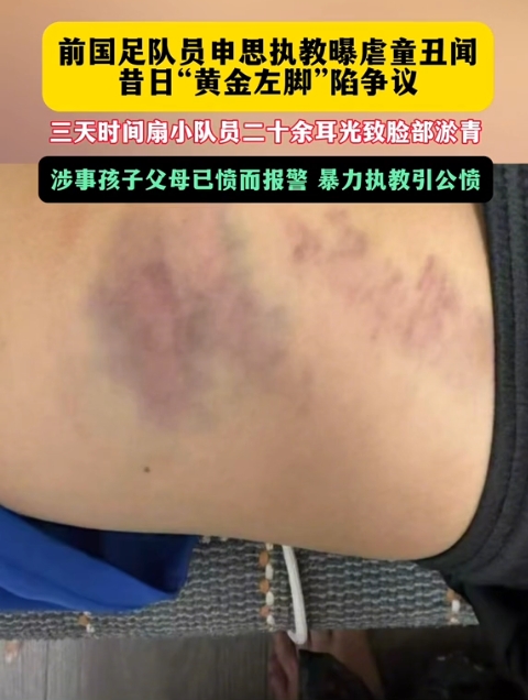 前国脚申思训练中连续掌掴小球员,家长已报警 前国脚申思训练中连续掌掴小球员,家长已报警